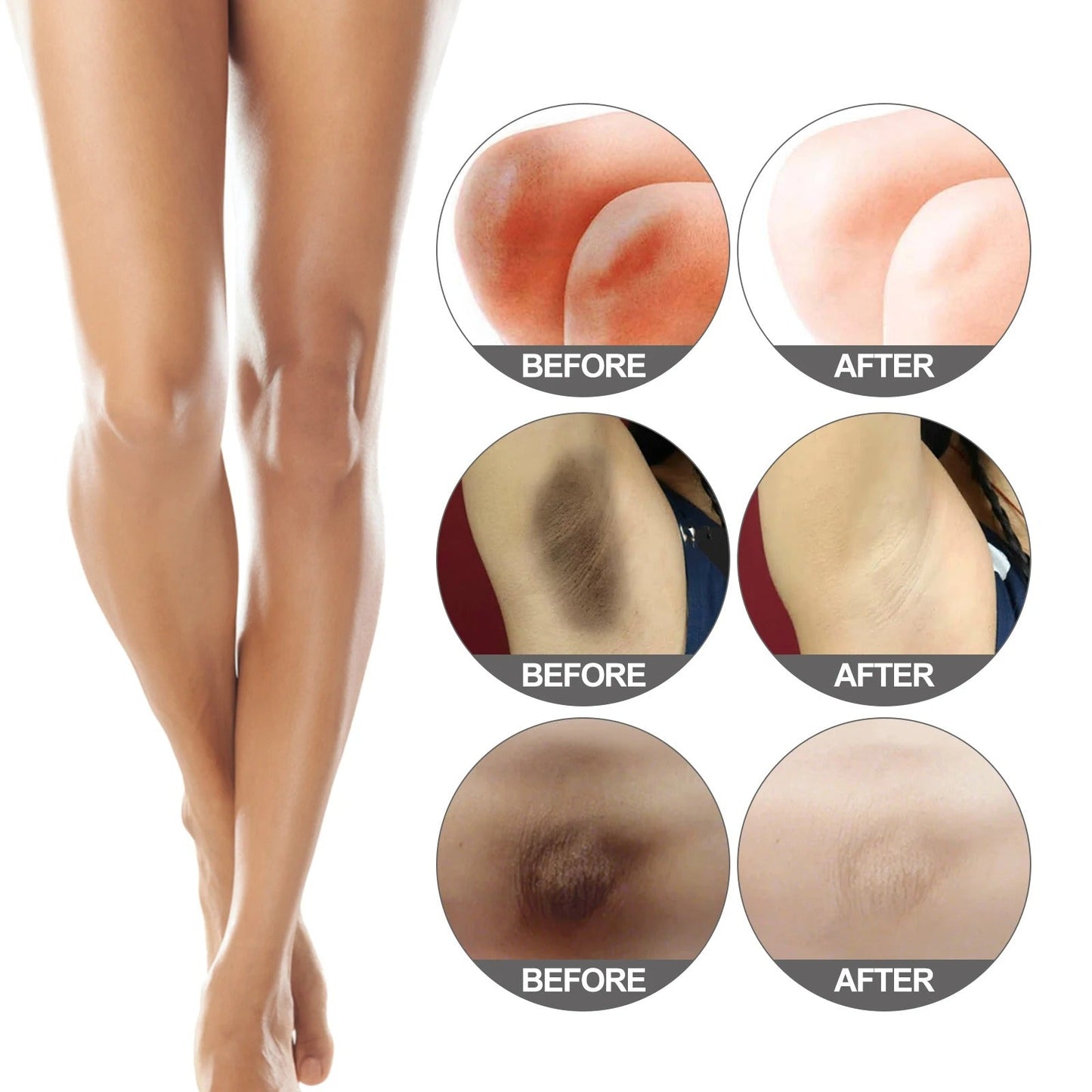 Body Whitening Bleach Cream